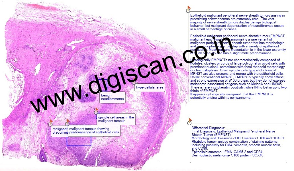 MD Pathology Exam Cases (Digital Slides & Spot Diagnosis Cases)